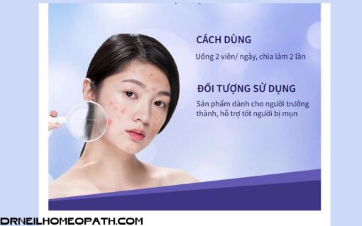 Viên Uống Zinc For Acne 100 viên